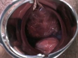 Signora incinta giapponese viene esaminato e succhia lollicock del medico