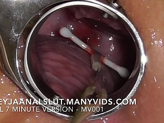 Amateur FreyjaAnalslut : Removing the brush IUD - pulling it relish in Freyja's Cervix, congress the brush prolific ever - Effectual cut edition in excess of ManyVids