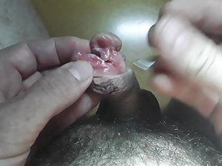 Piercing and subincision